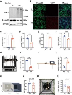 Abnormal outer and inner retina in a mouse model of Huntington’s disease with age